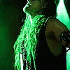 Sarkom 02.JPG